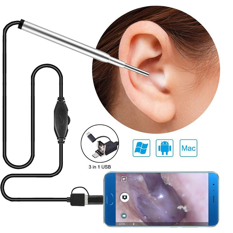 Endoscópio médico câmera orelha endoscópio nasal usb Otoscópio